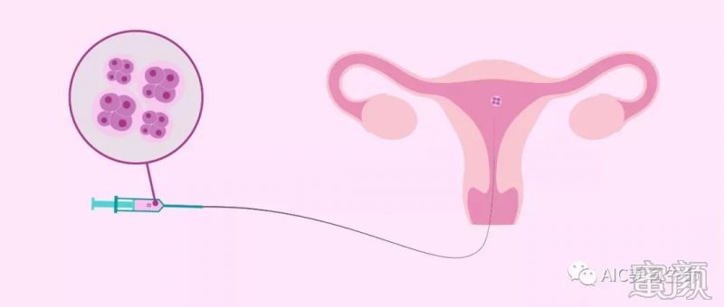 体外子宫探查试验是否必须进行？其目的是什么？