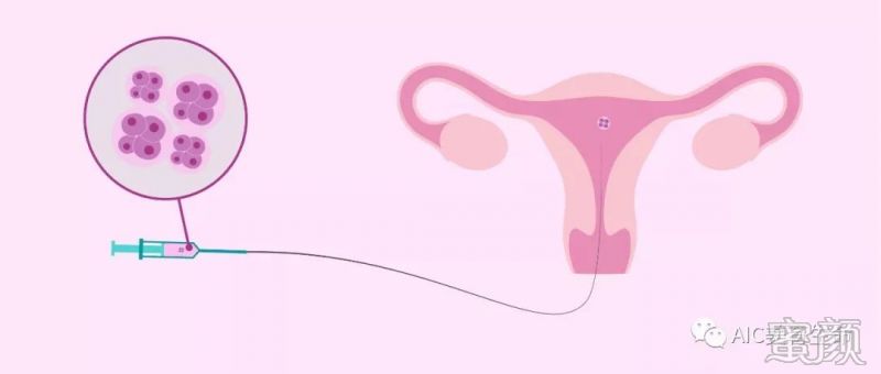 体外子宫探查试验是否必须进行？其目的是什么？