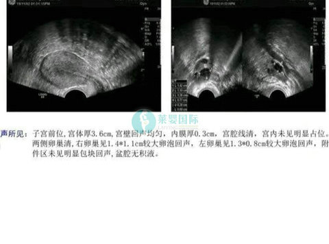 上海试管医院哪家医院最好影响男性精子质量因素有哪些+如何提高精子质量+