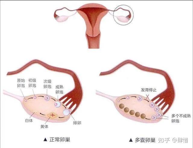 试管取卵前吃什么好