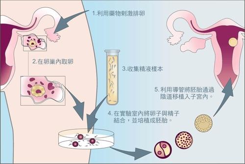 2024上海les女性试管供卵代生机构攻略-费用30万左右